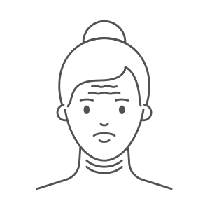 Graphic Depicting Sagging on the Face