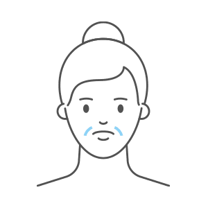Graphic Showing Smile Lines