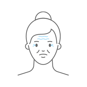 Graphic of Face Showing Wrinkles Lines on the Forehead and Eyes